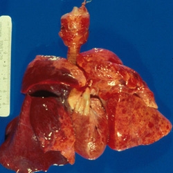imagine cu edemul pulmonar
